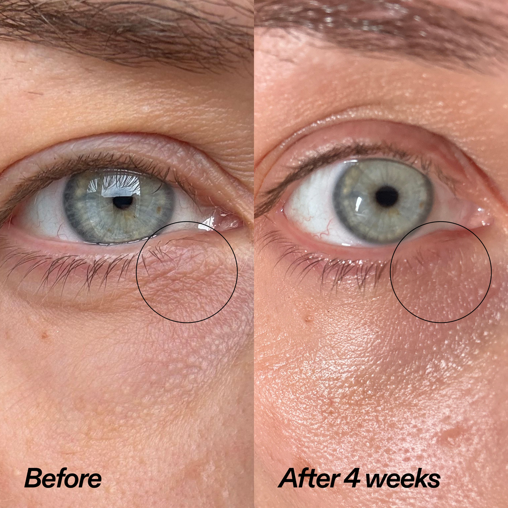 Bio-Active Ceramide Eye Cream