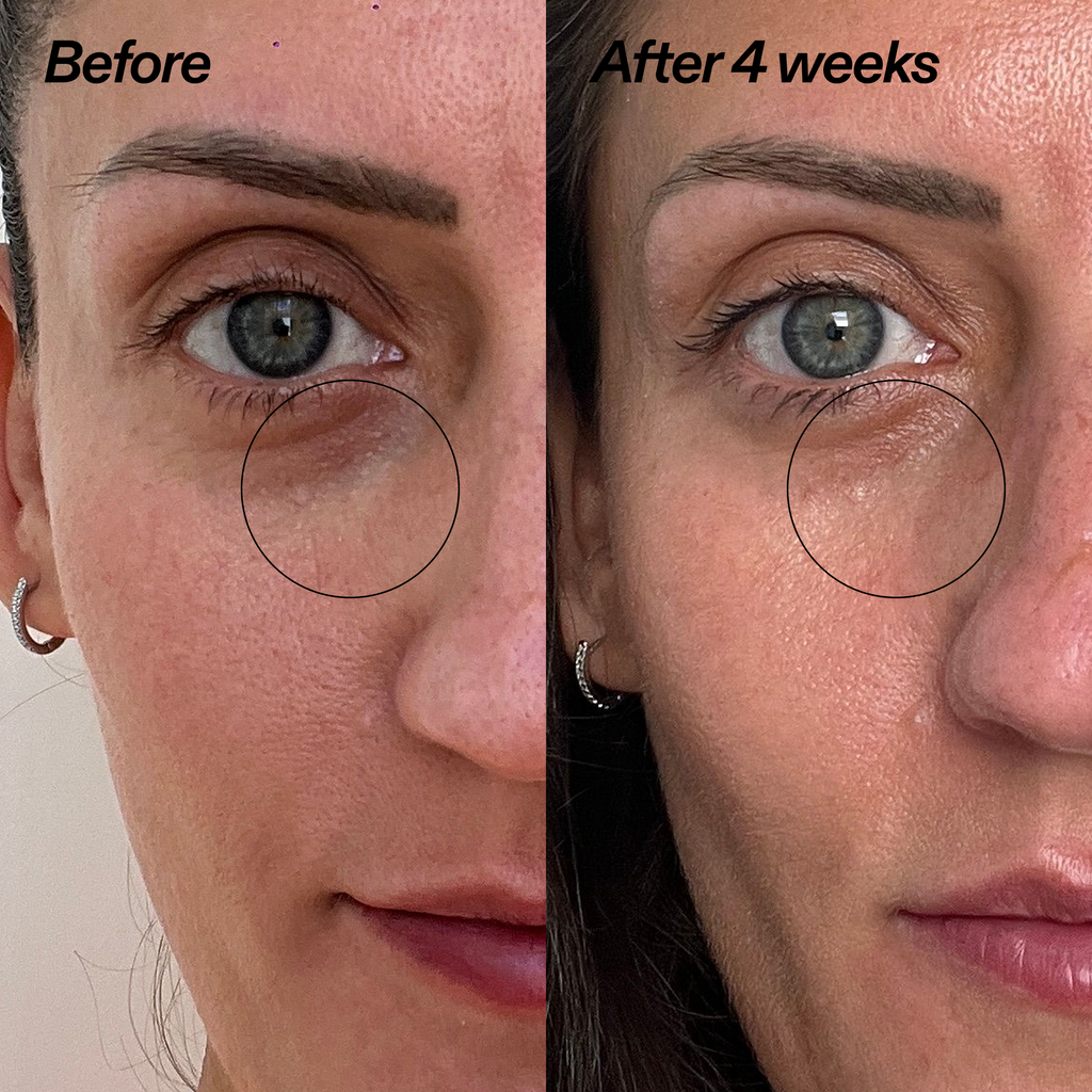 Bio-Active Ceramide Eye Cream