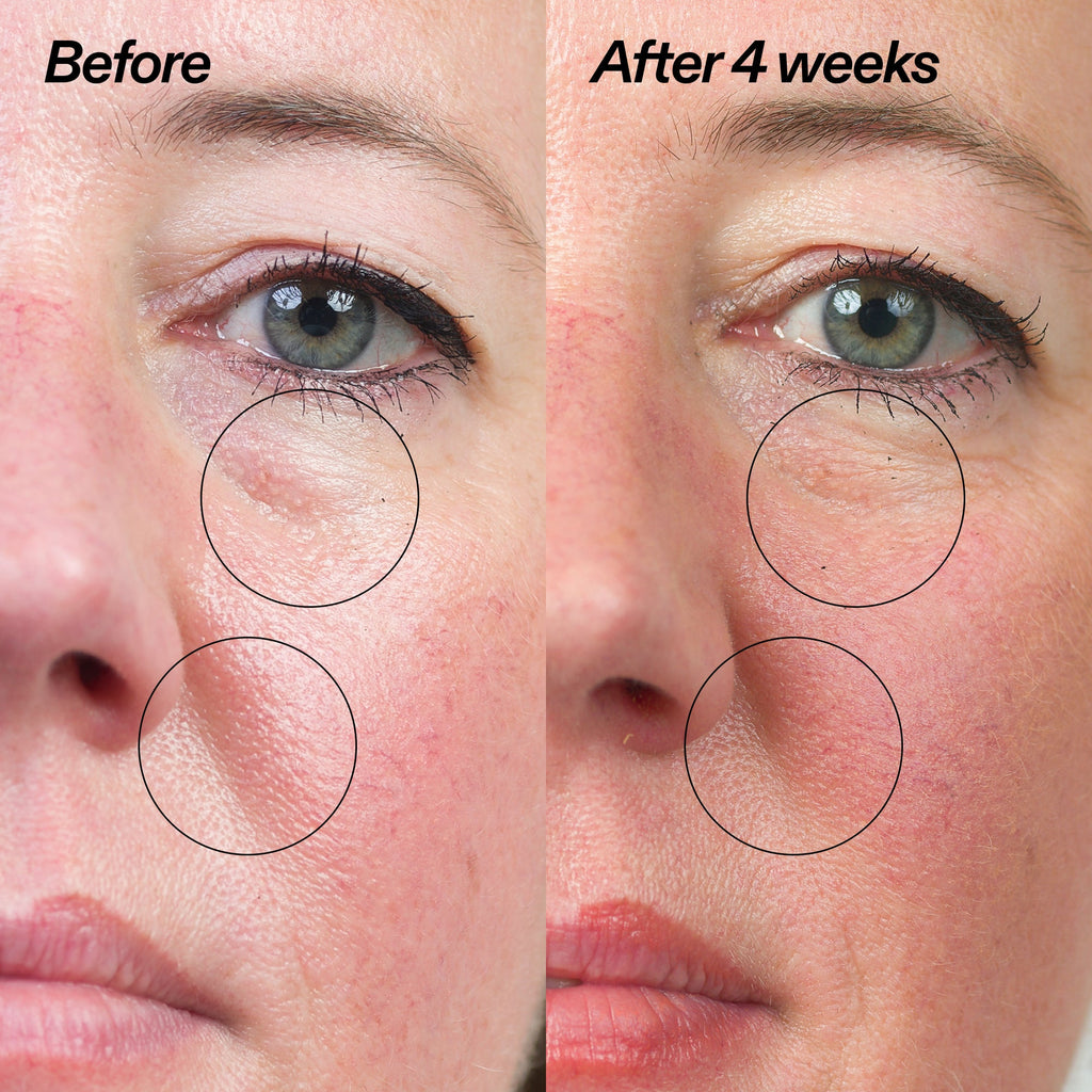 Bio-Active Ceramide Moisturizer Duo