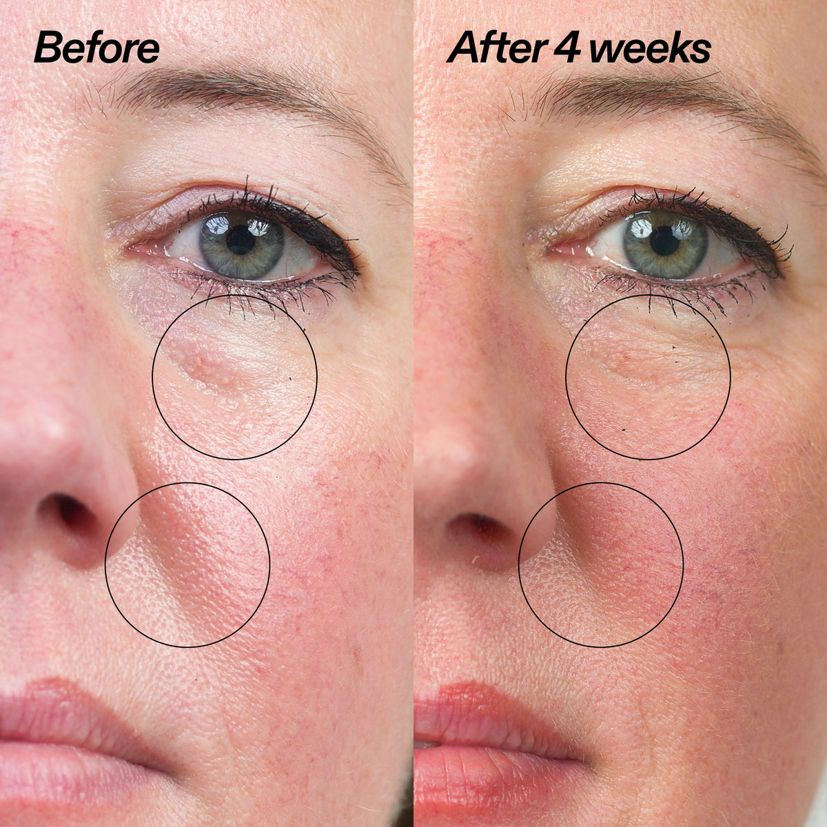 Bio-Active Ceramide Moisturizer Duo