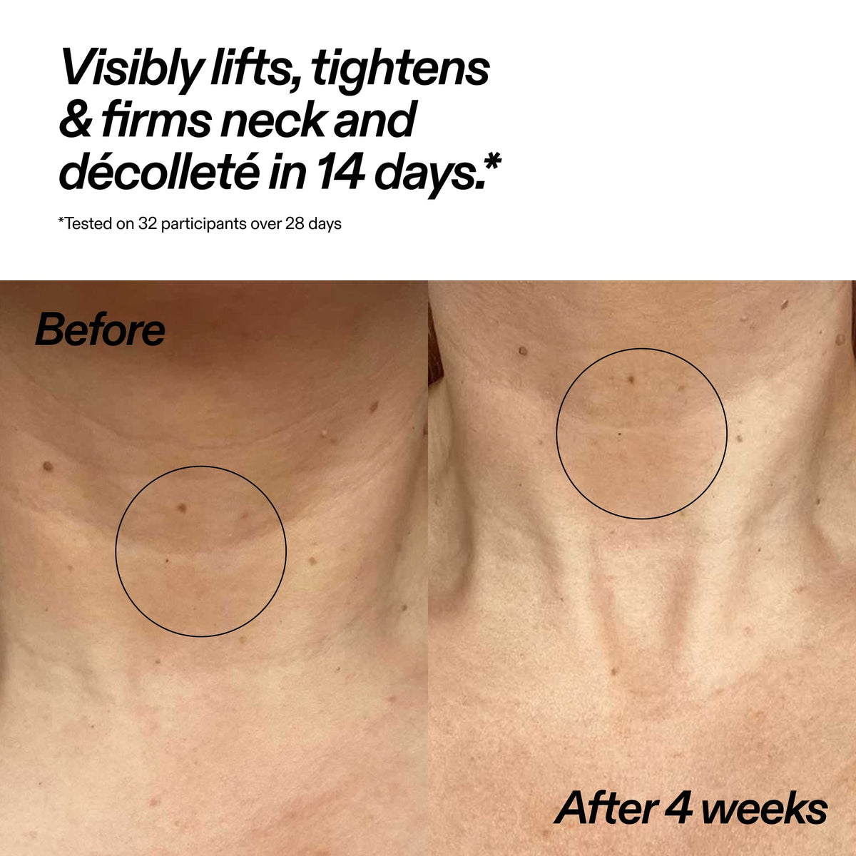 Bio-Active Ceramide Neck Stick