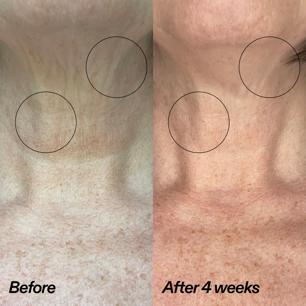 Bio-Active Ceramide Neck Stick